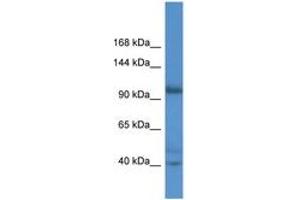 AFAP1L2 antibody  (AA 66-115)