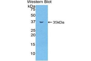 Western Blotting (WB) image for anti-Sphingomyelin phosphodiesterase 1, Acid Lysosomal (SMPD1) (AA 319-579) antibody (ABIN1858086)