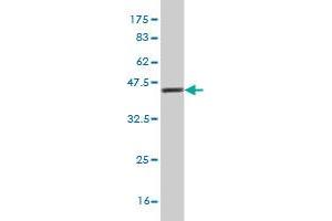 Western Blot detection against Immunogen (37. (PICK1 antibody  (AA 266-375))