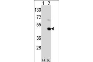 Western blot analysis of GEA9 (arrow) using rabbit polyclonal GEA9 Antibody  (ABIN390111 and ABIN2840622). (MAGEA9 antibody  (AA 171-198))