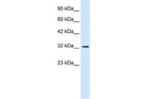 Western Blotting (WB) image for anti-SWI/SNF Related, Matrix Associated, Actin Dependent Regulator of Chromatin, Subfamily A, Member 2 (SMARCA2) antibody (ABIN2460965)