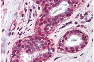 Human Breast (formalin-fixed, paraffin-embedded) stained with TLR4 antibody ABIN298531 at 5 ug/ml followed by biotinylated anti-mouse IgG secondary antibody ABIN481714, alkaline phosphatase-streptavidin and chromogen. (TLR4 antibody  (AA 100-200))