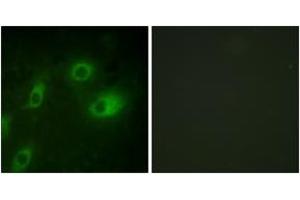 Immunofluorescence analysis of HeLa cells, using Keratin 18 (Phospho-Ser52) Antibody. (Cytokeratin 18 antibody  (pSer52))