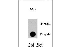 Dot blot analysis of anti-PIK3CD-p Phospho-specific Pab (R) on nitrocellulose membrane.