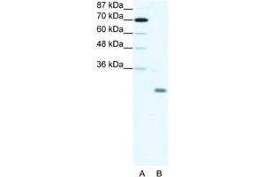 Western Blotting (WB) image for anti-Inhibitor of DNA Binding 4, Dominant Negative Helix-Loop-Helix Protein (ID4) antibody (ABIN2461635) (ID4 antibody)