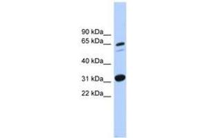 Image no. 1 for anti-Integrin alpha FG-GAP Repeat Containing 3 (ITFG3) (AA 431-480) antibody (ABIN6744874) (ITFG3 antibody  (AA 431-480))