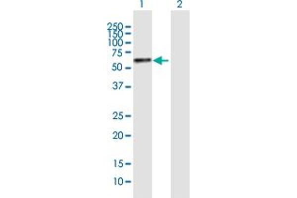 YTHDF2 anticorps  (AA 1-579)