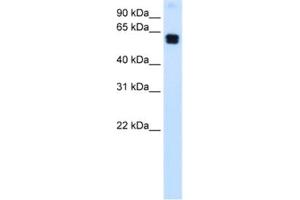 Western Blotting (WB) image for anti-Docking Protein 1, 62kDa (Downstream of tyrosine Kinase 1) (DOK1) antibody (ABIN2463701) (DOK1 antibody)