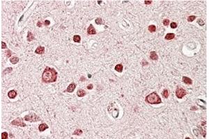 AP23695PU-N STK39 / SPAK Antibody staining of paraffin embedded Human Cerebral Cortex at 3. (STK39 antibody  (Internal Region))