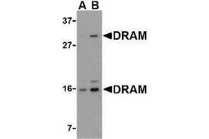 Western blot analysis of DRAM in 293 cell lysate with AP30304PU-N DRAM antibody at (A) 0.