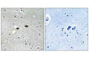 Immunohistochemistry analysis of paraffin-embedded human brain tissue, using TIGD3 antibody.