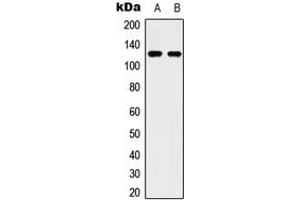 Western blot analysis of ULK2 expression in Hela (A), HepG2 (B) whole cell lysates. (ULK2 antibody  (C-Term))