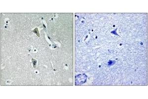 Immunohistochemistry analysis of paraffin-embedded human brain, using PKC thet (Phospho-Thr538) Antibody. (PKC theta antibody  (pThr538))