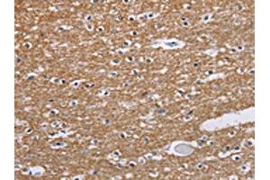 The image on the left is immunohistochemistry of paraffin-embedded Human brain tissue using ABIN7191592(NCR2 Antibody) at dilution 1/60, on the right is treated with synthetic peptide. (NKp44/NCR2 antibody)