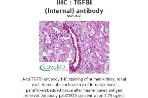 Image no. 1 for anti-Transforming Growth Factor, beta-Induced, 68kDa (TGFBI) (Internal Region) antibody (ABIN1740014) (TGFBI antibody  (Internal Region))