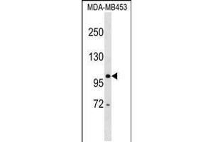 Western blot analysis in MDA-MB453 cell line lysates (35ug/lane). (DDX24 antibody  (AA 506-534))