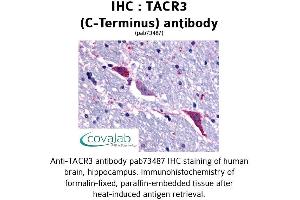 Image no. 1 for anti-Tachykinin Receptor 3 (TACR3) (C-Term), (Cytoplasmic Domain) antibody (ABIN1739880)