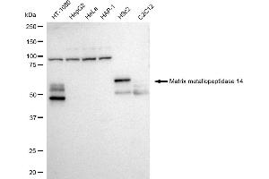 Western blotting analysis using Matrix metallopeptidase 14 antibody (ABIN7799340). (Recombinant MMP14 antibody)