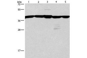 Western Blot analysis of A172 and 293T cell, Mouse kidney tissue, Human testis and brain malignant glioma tissue using GNA13 Polyclonal Antibody at dilution of 1:600