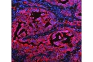 IF analysis of Cytokeratin 20/Krt20 using anti-Cytokeratin 20/Krt20 antibody (ABIN7601133). (KRT20 antibody  (AA 29-431))