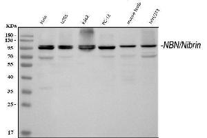 Western blot analysis of p95 NBS1 using anti-p95 NBS1 antibody (ABIN3043282).