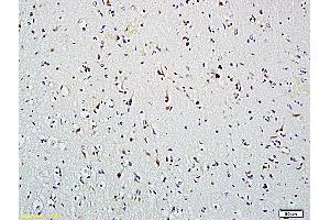 Formalin-fixed and paraffin embedded human brain labeled with Anti-HDAC2, Unconjugated (ABIN734813) followed by conjugation to the secondary antibody and DAB staining (HDAC2 antibody  (AA 391-488))