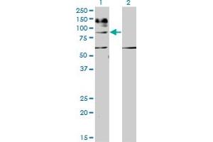 Western Blot analysis of IL31RA expression in transfected 293T cell line by IL31RA monoclonal antibody (M01), clone 3A10. (IL31RA antibody  (AA 21-120))
