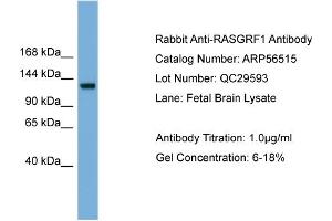 WB Suggested Anti-RASGRF1  Antibody Titration: 0.