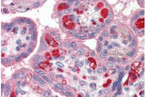 Human Placenta (formalin-fixed, paraffin-embedded) stained with PLTP antibody ABIN337143 at 1:100 followed by biotinylated goat anti-rabbit IgG secondary antibody ABIN481713, alkaline phosphatase-streptavidin and chromogen. (PLTP antibody)