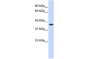 WB Suggested Anti-ZNF444 Antibody Titration:  0. (ZNF444 antibody  (Middle Region))