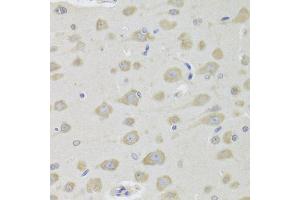 Immunohistochemistry of paraffin-embedded rat brain using DHRS9 Antibody (ABIN1980340) at dilution of 1:100 (40x lens).