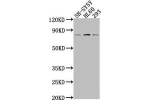 Western Blot Positive WB detected in: SH-SY5Y whole cell lysate, HL60 whole cell lysate, 293 whole cell lysate All lanes: CEACAM5 antibody at 1:2000 Secondary Goat polyclonal to rabbit IgG at 1/50000 dilution Predicted band size: 77 kDa Observed band size: 77 kDa (CEACAM5 antibody  (AA 1-255))