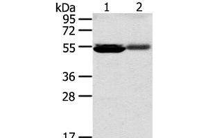 Western Blot analysis of Human kidney pericarcinous and kidney cancer tissue using SLC17A1 Polyclonal Antibody at dilution of 1:200