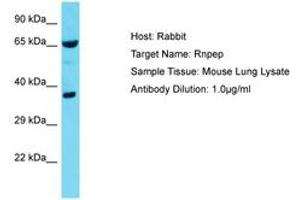 Image no. 1 for anti-Arginyl Aminopeptidase (Aminopeptidase B) (RNPEP) (AA 329-378) antibody (ABIN6750383) (RNPEP antibody  (AA 329-378))
