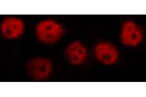 ABIN6269231 staining Hela by IF/ICC. (PPARG antibody  (Internal Region))
