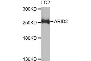 Western blot analysis of extracts of LO2 cells, using ARID2 antibody (ABIN5996429) at 1/1000 dilution. (ARID2 antibody)