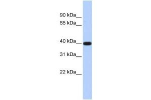 Western Blotting (WB) image for anti-Lipid Phosphate Phosphatase-Related Protein Type 5 (LPPR5) antibody (ABIN2458867) (LPPR5 antibody)