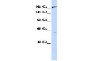 WB Suggested Anti-ABCC1 Antibody Titration:  0. (ABCC1 antibody  (Middle Region))
