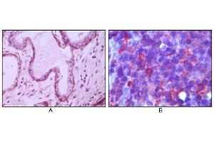 Immunohistochemical analysis of paraffin-embedded human breast ductal myoepithelium (A) and lymph tissue (B), showing cytoplasmic (A) and membrane (B) localization using CD10 mouse mAb with DAB staining (A) and AEC staining (B).