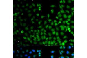 Immunofluorescence analysis of A549 cells using LHX6 Polyclonal Antibody (LHX6 antibody)