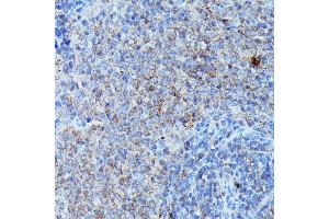 Immunohistochemistry (IHC) image for anti-Colony Stimulating Factor 3 (Granulocyte) (CSF3) (AA 30-207) antibody (ABIN6139100)