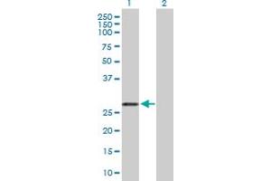Western Blot analysis of ARHGDIA expression in transfected 293T cell line by ARHGDIA MaxPab polyclonal antibody. (ARHGDIA antibody  (AA 1-204))