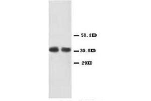 Western blot analysis of human carcinoma of colon lysis using CXCR2 antibody (CXCR2 antibody  (Middle Region))