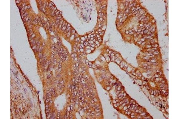 Zinc Finger Protein 650 (ZNF650) (AA 960-1113) antibody