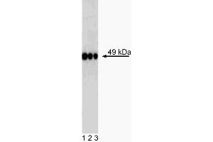 Western blot analysis of TAZ in transformed human epithelioid carcinoma. (TAZ antibody)