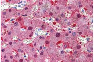 Human Liver: Formalin-Fixed, Paraffin-Embedded (FFPE) (CAD antibody  (AA 1625-1900))