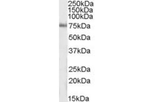 Western Blotting (WB) image for anti-Inositol-Trisphosphate 3-Kinase C (ITPKC) (Internal Region) antibody (ABIN2464190) (ITPKC antibody  (Internal Region))