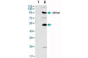 Western blot analysis using CSF1 monoclonal antibody, clone 2D10  against human recombinant CSF2 (1) and CSF1 (2) . (M-CSF/CSF1 antibody)