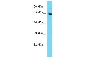Host: Rabbit  Target Name: Nploc4  Sample Tissue: Mouse Testis lysates  Antibody Dilution: 1. (NPLOC4 antibody  (N-Term))