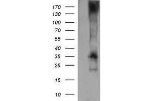 Western Blotting (WB) image for anti-T-cell surface glycoprotein CD1c (CD1C) antibody (ABIN2670658) (CD1c antibody)
